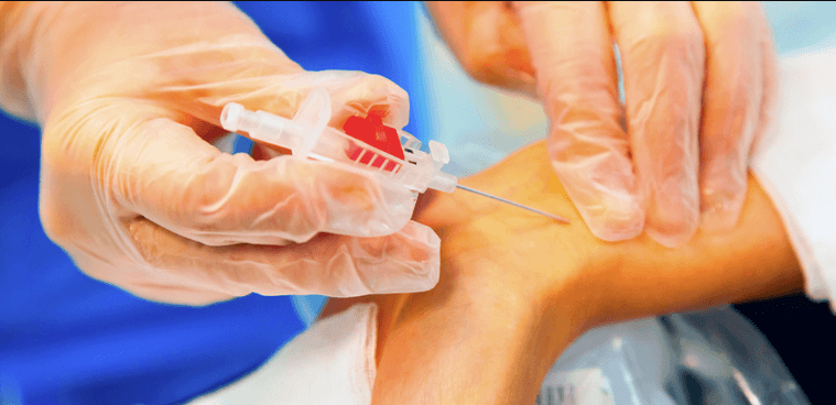 Que es un Equipo de Venoclisis: Conceptos Clave para el Personal de Salud